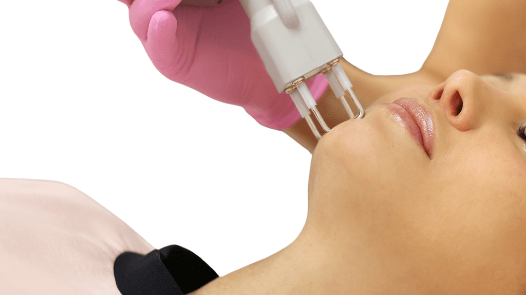 Fractional CO2 Laser